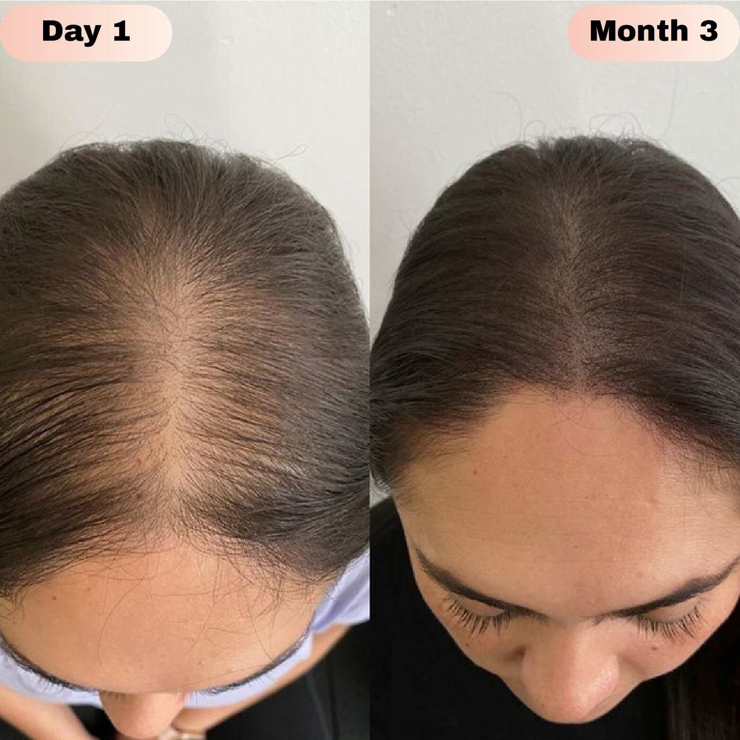 Elivra™ Advanced Hair Growth Roll On Serum - Elivra™