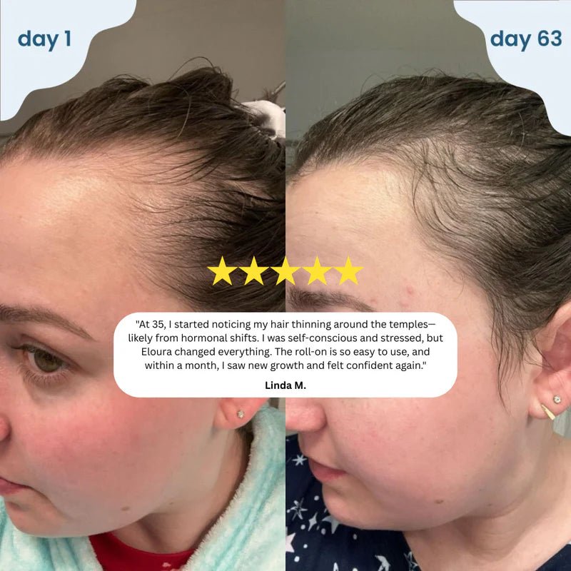 Elivra™ Advanced Hair Growth Roll On Serum - Elivra™