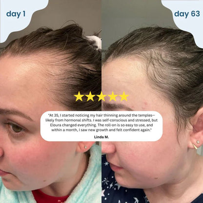 Elivra™ Advanced Hair Growth Roll On Serum - Elivra™