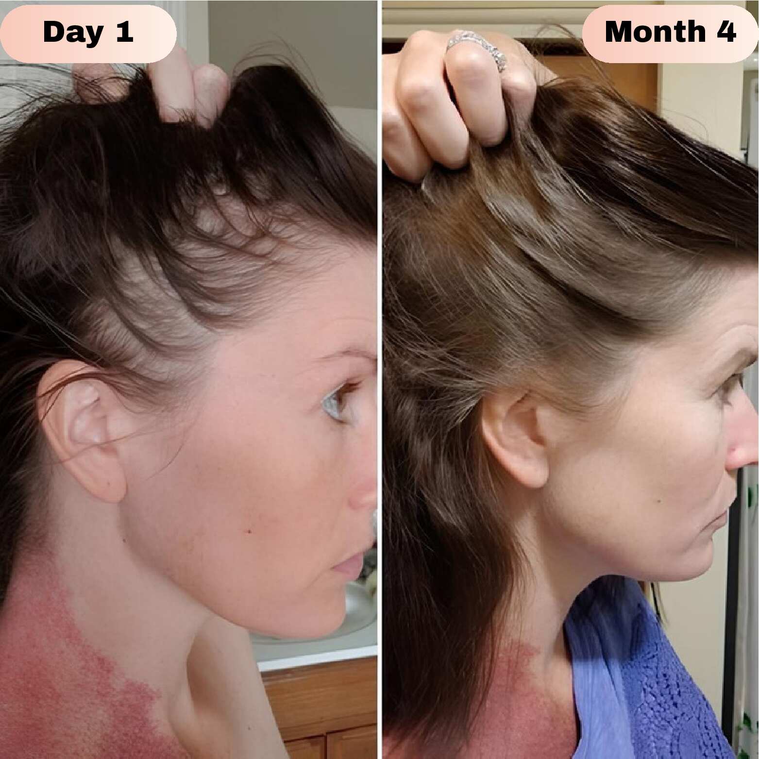 Elivra™ Advanced Hair Growth Roll On Serum - Elivra™