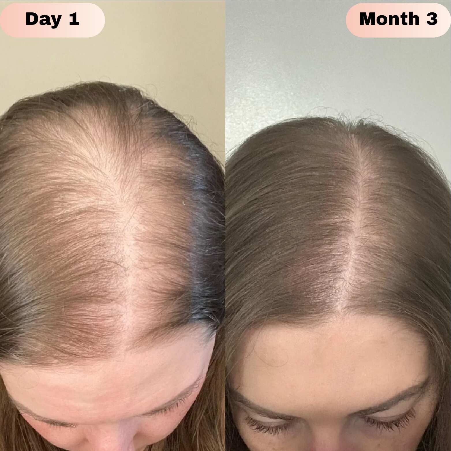 Elivra™ Advanced Hair Growth Roll On Serum - Elivra™