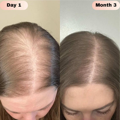 Elivra™ Advanced Hair Growth Roll On Serum - Elivra™