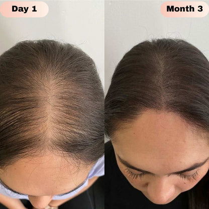 Elivra™ Advanced Hair Growth Roll On Serum - Elivra™